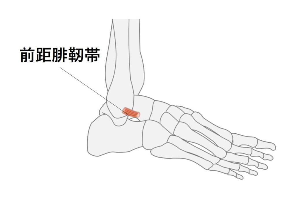 前距腓靭帯