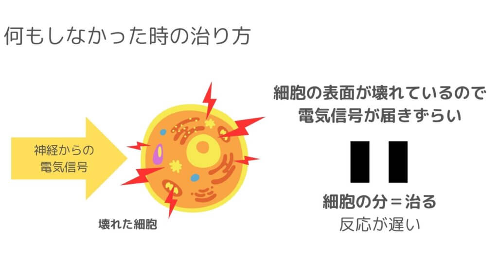 アキュスコープはなんで効くのか？ | 尾山台駅前整骨院・整体院 凌心堂｜東急大井町線尾山台駅より徒歩30秒