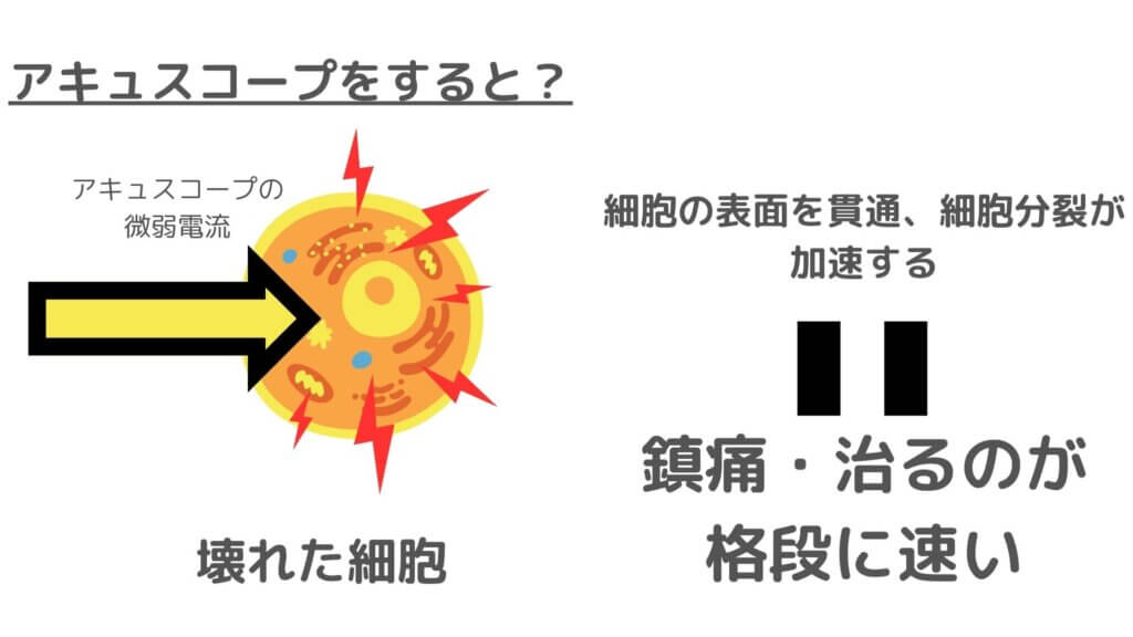 アキュスコープはなんで効くのか？ | 尾山台駅前整骨院・整体院 凌心堂｜東急大井町線尾山台駅より徒歩30秒