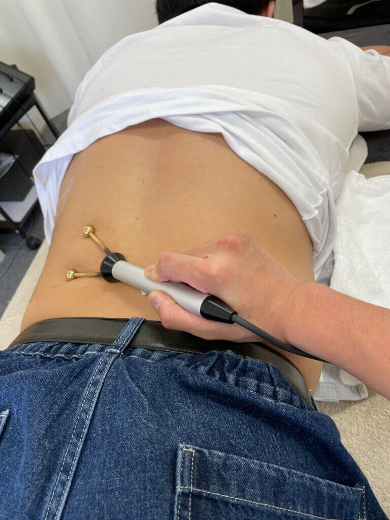 背中のケガに対してアキュスコープをしている写真