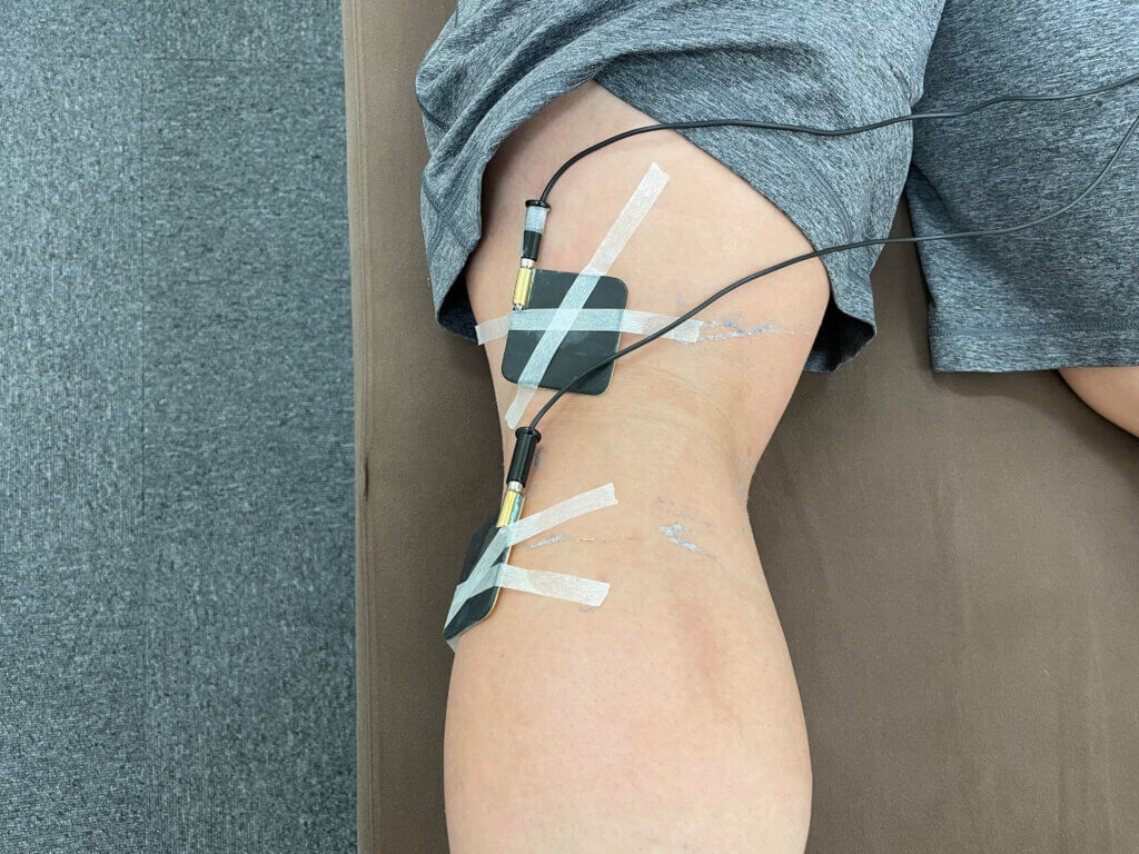 膝のケガに対してアキュスコープをしている写真