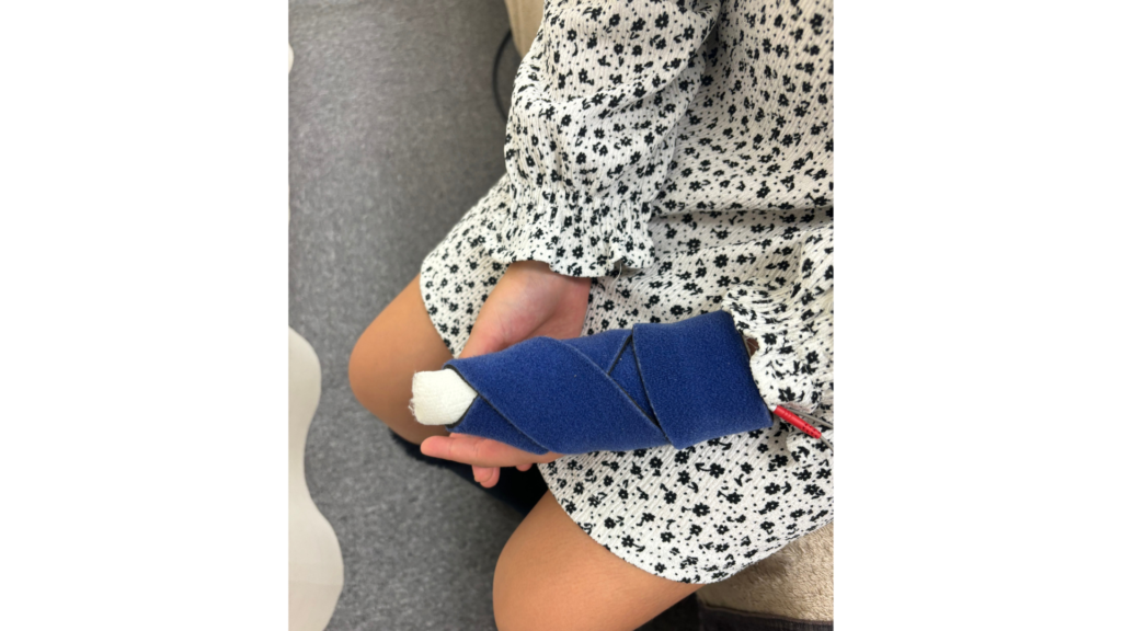 第一基節骨不全骨折に
アキュスコープ